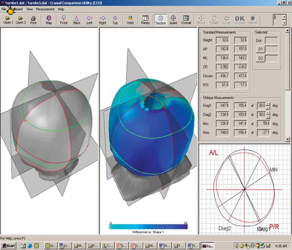 STARscanner Orthomerica Products, Inc.
